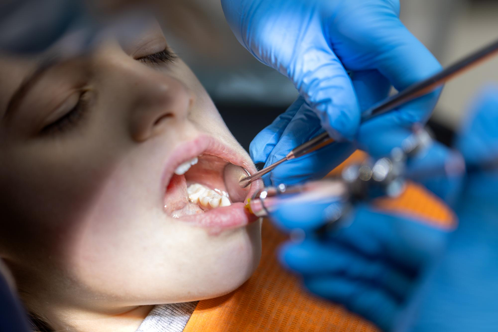 tooth-fillings