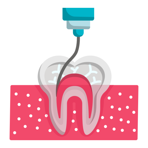 Root canal treatment